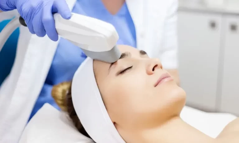 Pico Laser Treatment