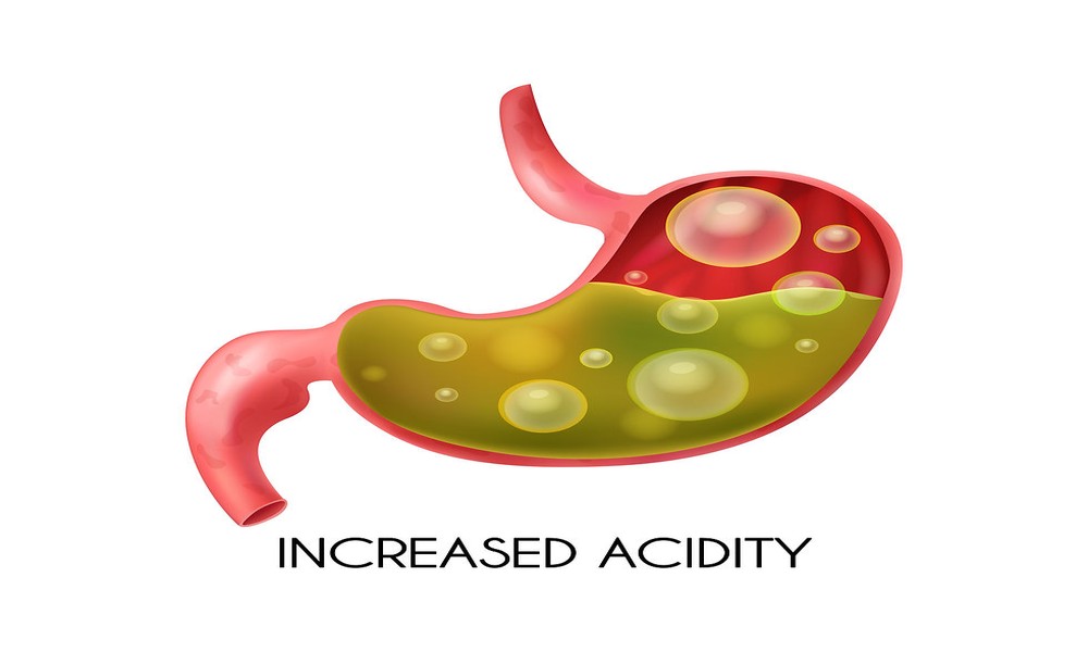 Hydrox Defecation The Gut Connection: How Hypochlorhydria Contributes to IBS, SIBO, and ...